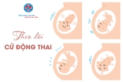 Theo dõi cử động thai