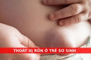 THOÁT VỊ RỐN – OMPHALOCELE