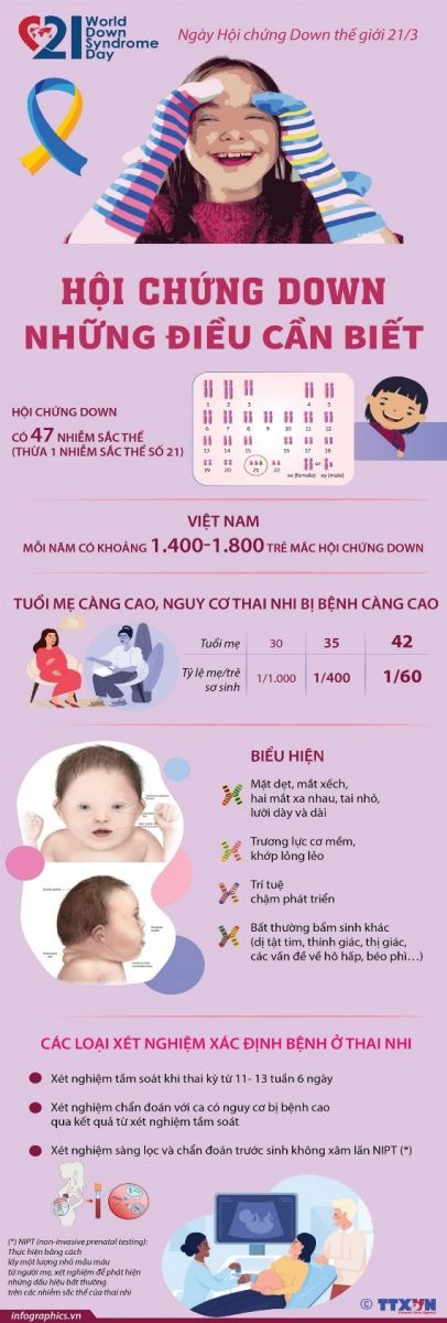 10. Các Nghiên Cứu Liên Quan Đến Hội Chứng Down